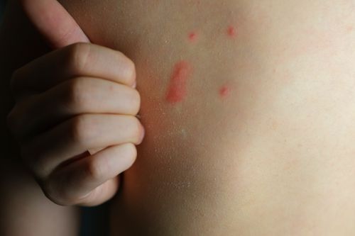 Lignée de boutons de punaises